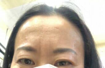 My Coronavirus Story